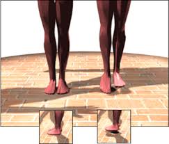 David Blaine Levitation