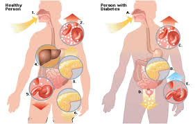 asuhan keperawatan diabetes mellitus