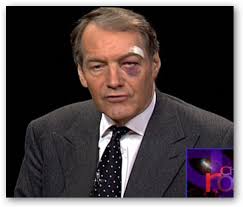 Charlie Rose Black Eye, ... - 2343121516_21db81c567_o