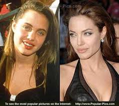 ... and After - Angelina Jolie