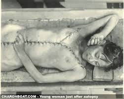 Medical → Young woman just after ...