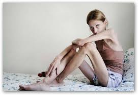 Foto di anoressia - it