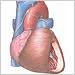 Hypertension. Hypertensive heart 
