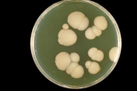 Natural Cure for BV that You Should Consider recurrent vaginosis