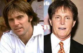 Bruce Jenner Plastic Surgery