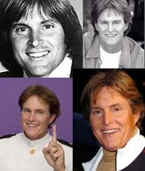 Bruce JennerAwful Plastic Surgery