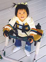 Photo of another Rett Syndrome