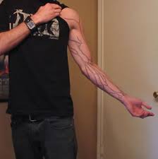 Short questions in the--Upper Limb